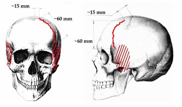 Смерть, идущая по следу… (интернет-версия) - Daytloffz_group_autops_Slobodin_4erep.jpg