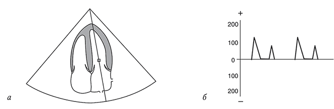 Пропедевтика внутренних болезней - i_045.png