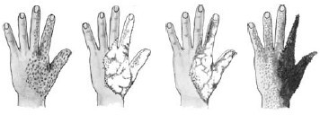 Безопасность ребенка. Первая помощь - _14.jpg