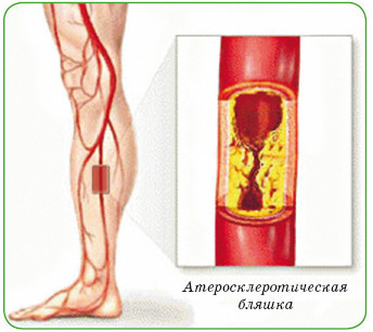 Энциклопедия диагностики и лечения от А до Я - i_031.jpg