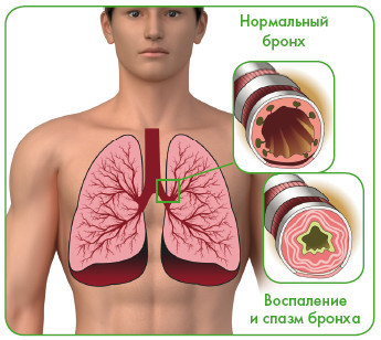 Энциклопедия диагностики и лечения от А до Я - i_048.jpg