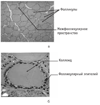 Глаукома и катаракта: лечение и профилактика - i_006.png