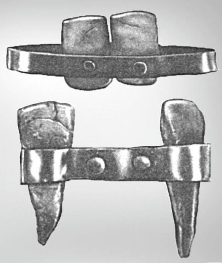 Из истории зубоврачевания, или Кто лечил зубы российским монархам - i_036.jpg