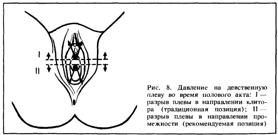 Искусство любви - _8.png