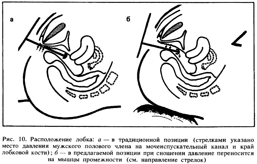 Искусство любви - _10.png