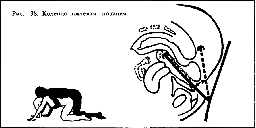 Искусство любви - _41.png_0.png