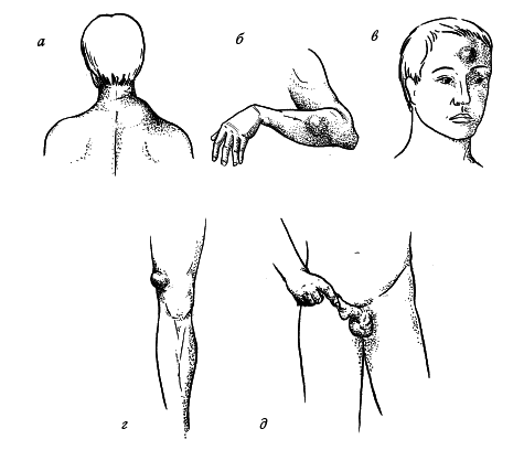 Лечение болезней и дефектов кожи. И жировик исчез, и бородавки - i_001.png