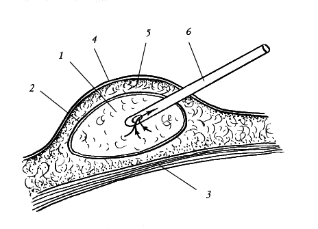 Лечение болезней и дефектов кожи. И жировик исчез, и бородавки - i_004.png