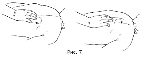 Массаж при половых расстройствах - pic_7.png