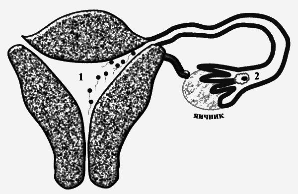 Бесплодие – не приговор! - _04.png