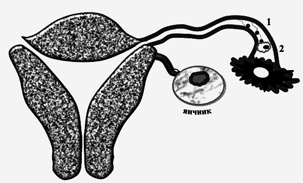 Бесплодие – не приговор! - _05.png