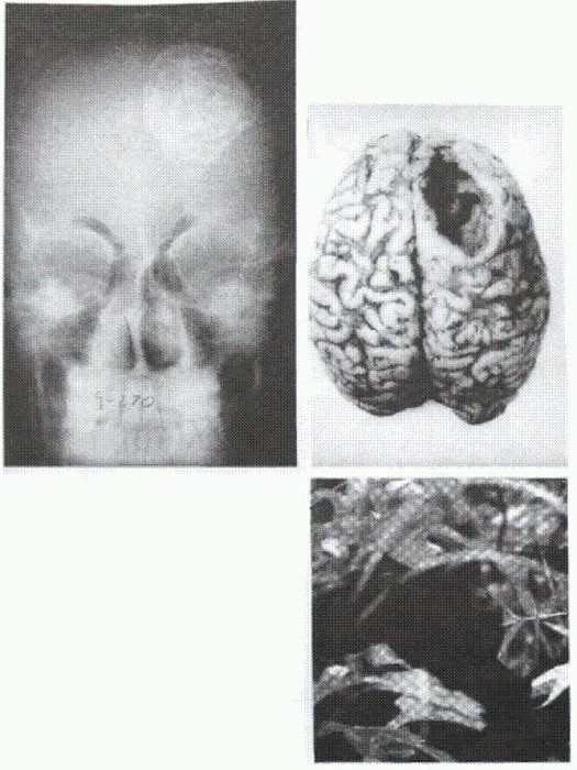 Паразиты. Тайный мир - image019.jpg