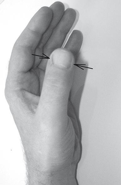 Атлас целительных точек. Печень, почки, желудок - i_010.jpg