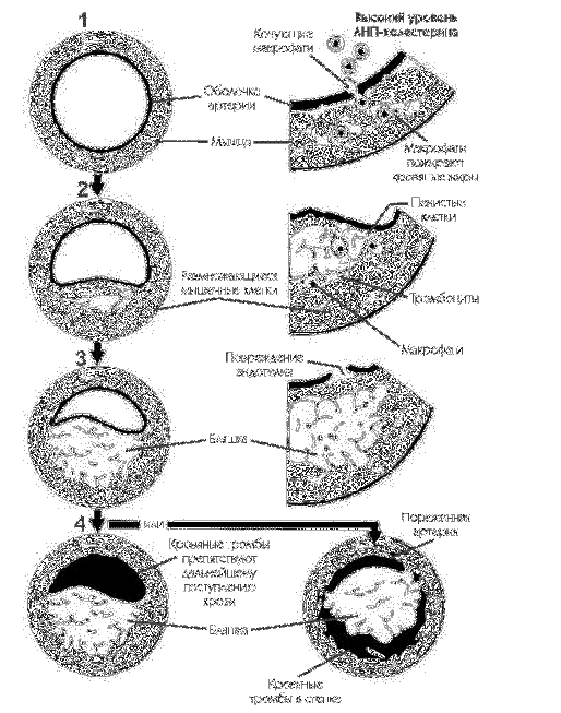 Сердечно-сосудистые заболевания. Карманный справочник - i_003.png