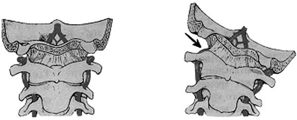 Гимнастика для сосудов - i_004.jpg