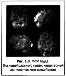 Великолепный мозг в любом возрасте - img06.png