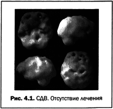 Великолепный мозг в любом возрасте - img13.png