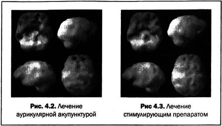 Великолепный мозг в любом возрасте - img14.png