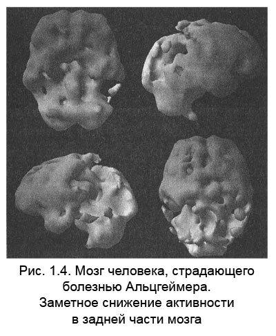 Измени мозг - изменится и тело - _5.jpg