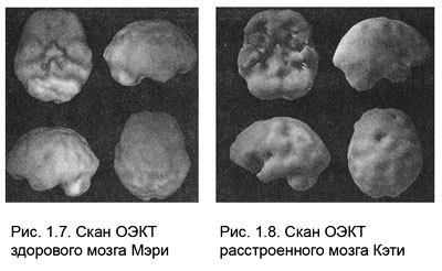 Измени мозг - изменится и тело - _7.jpg