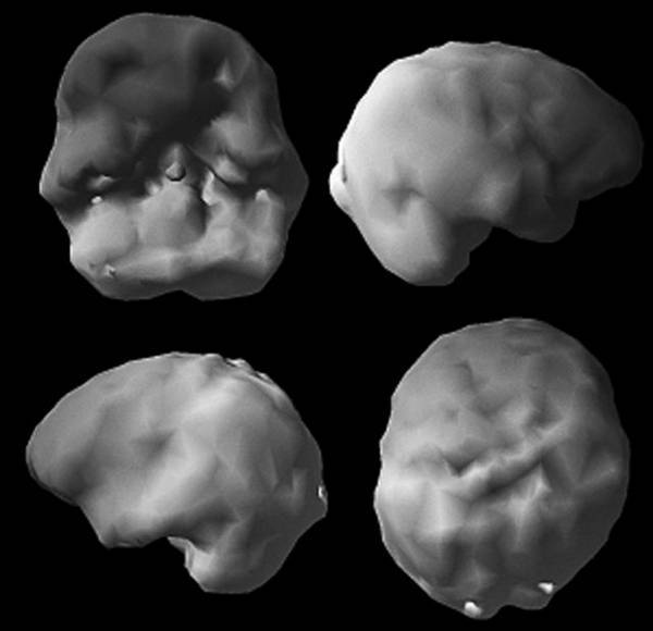 Измени свой мозг – изменится и возраст! - i_013.jpg