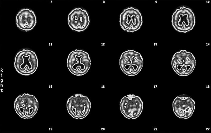 Измени свой мозг – изменится и возраст! - i_019.jpg