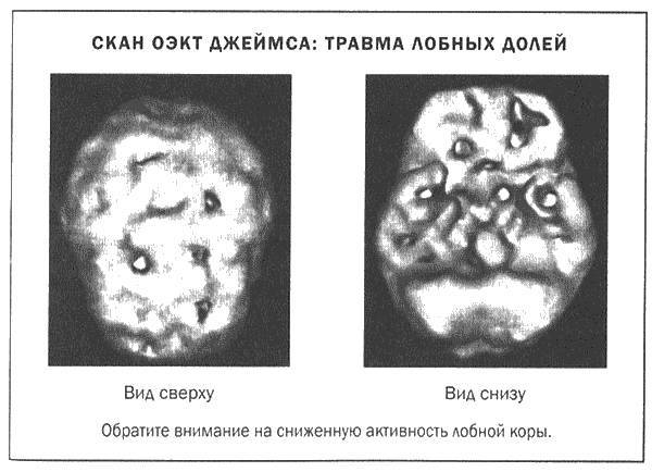 Мозг и душа - _10.jpg
