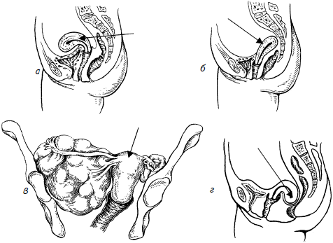 Гимнастика для женщин - i_010.png