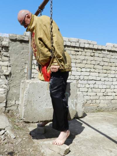 Мегасила икроножных мышц голени - i_015.jpg