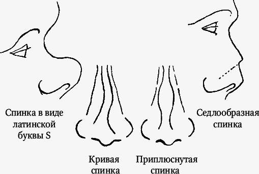 Как распознать преступника - _030.png