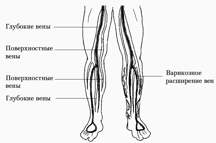 Варикозное расширение вен. Лечение традиционными и нетрадиционными методами - _00_1.png