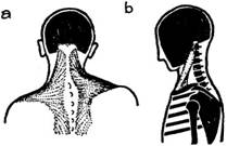 Техника Александера (ЛП) - i_012.jpg