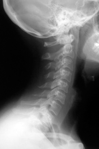 Самомоделирование тела и лица. Система Осьмионика. Как обрести красивую осанку - r4.jpg