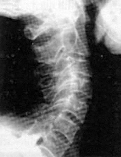 Самомоделирование тела и лица. Система Осьмионика. Как обрести красивую осанку - r5.jpg