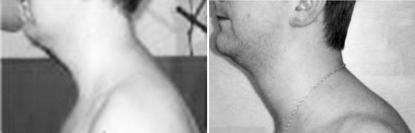 Самомоделирование тела и лица. Система Осьмионика. Как обрести красивую осанку - r7.jpg