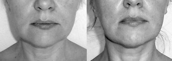 Самомоделирование тела и лица. Система Осьмионика. Как обрести красивую осанку - r9.jpg