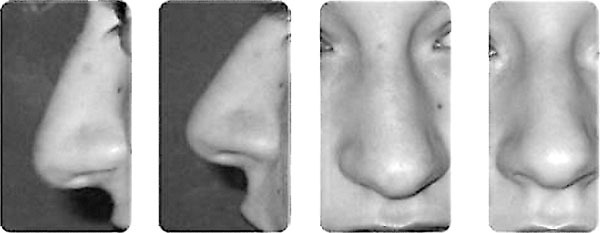 Самомоделирование тела и лица. Система Осьмионика. Как обрести красивую осанку - r13.jpg