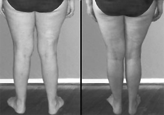 Система Осьмионика. Самомоделирование осанки. Коррекция верхней половины тела - _13.jpg