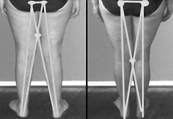 Система Осьмионика. Фасциальные растяжки тела - _13.jpg