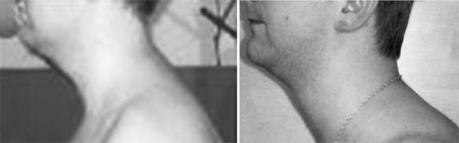 Система Осьмионика. Фасциальные растяжки тела - _22.jpg