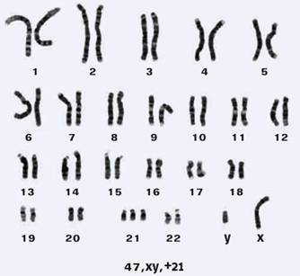 Замершая беременность - _8.jpg