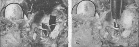 Совершенное зрение без очков - _25.jpg