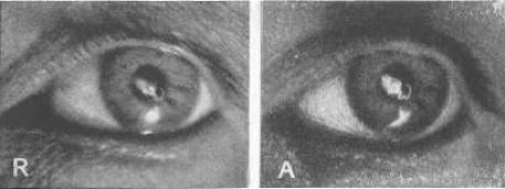Совершенное зрение без очков - _30.jpg