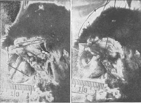 Совершенное зрение без очков - _21.jpg