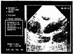 Искусственное осеменение собак - i_002.png
