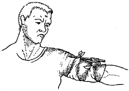 1000 советов опытного доктора. Как помочь себе и близким в экстремальных ситуациях - i_018.png