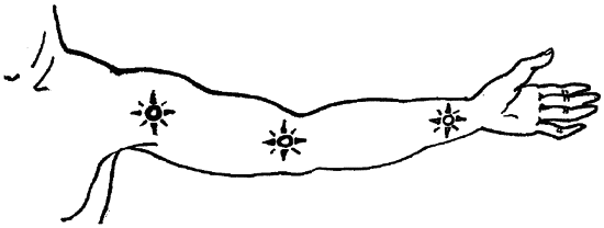 1000 советов опытного доктора. Как помочь себе и близким в экстремальных ситуациях - i_021.png