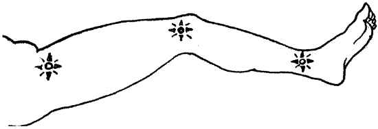 1000 советов опытного доктора. Как помочь себе и близким в экстремальных ситуациях - i_022.png