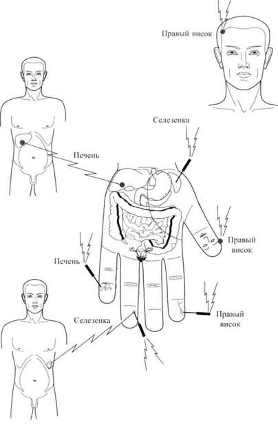 Су Джок семянотерапия - any2fbimgloader3.jpeg