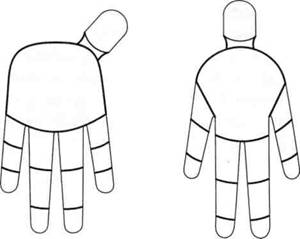 Су Джок семянотерапия - any2fbimgloader7.jpeg